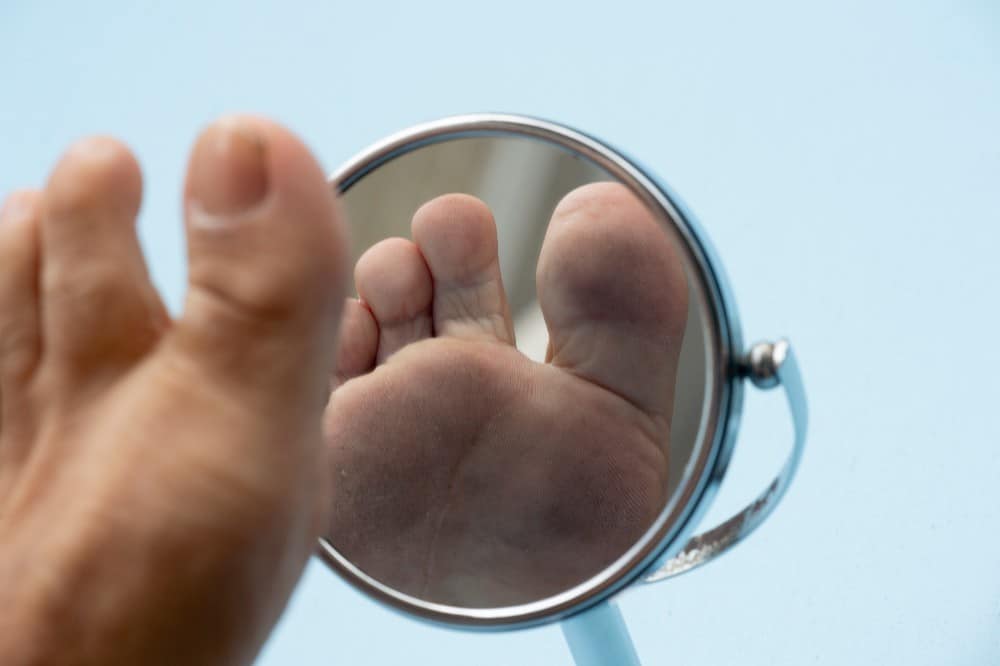 Using a mirror to check feet in diabetic foot care