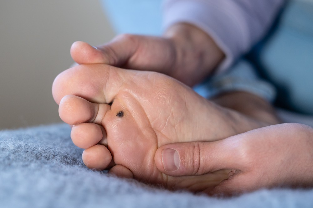Checking feet daily for diabetic foot care