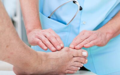 Top Causes of Bunions and Their Solutions